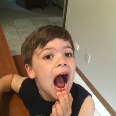 JB lost his first tooth